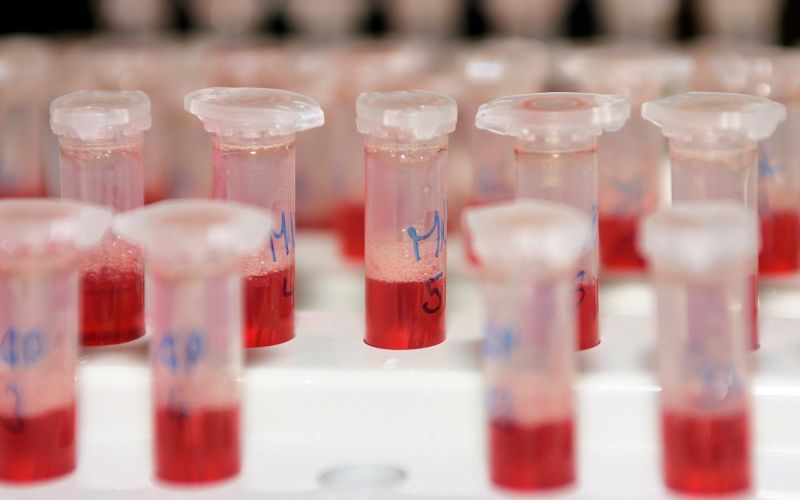 doping test.jpg