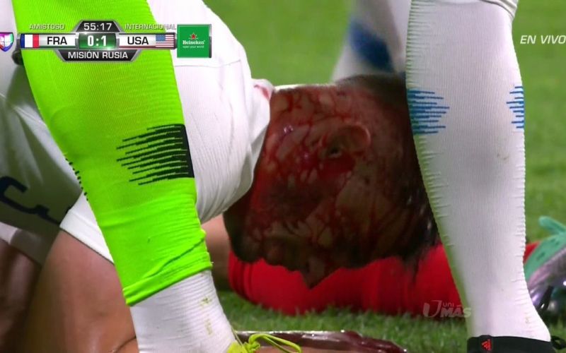 miazga.jpg