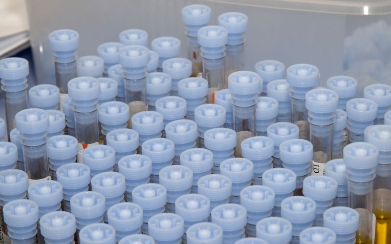 murska-sobota, oddelek-za-laboratorijsko-diagnostiko, splošna-bolnica-murska-sobota