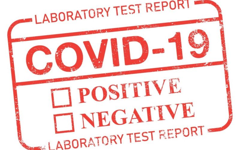 covid-19 lažni test policija_si.jpg