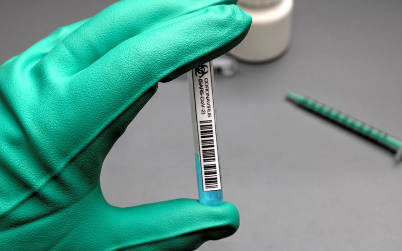 koronavirus, covid-19, epidemija