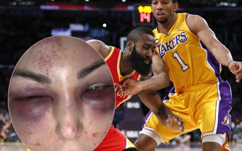 morris.jpg