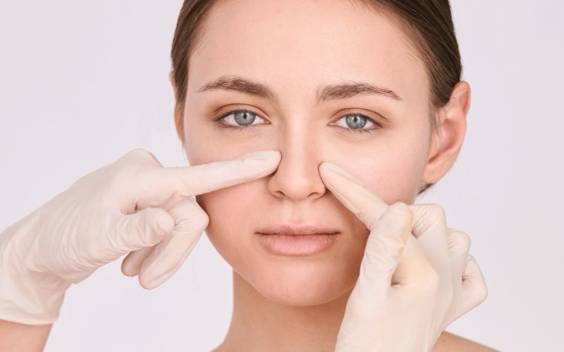 rinoplastika, operacija-nosu, nos