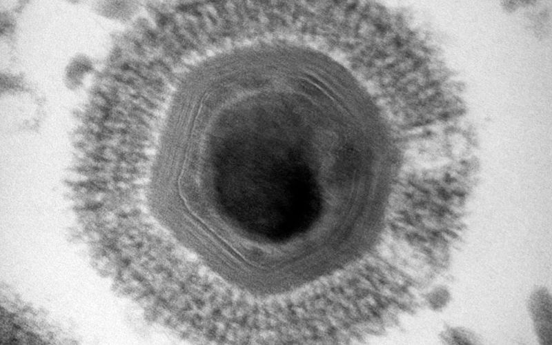Mimivirus