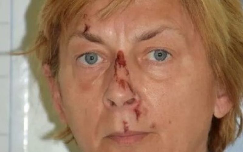 ženska, krk, daniela adamcova.jpg