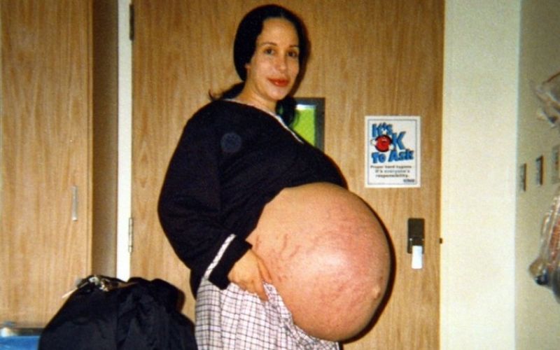 nadya-suleman