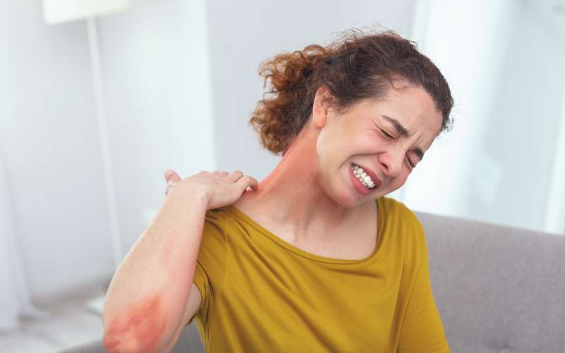 atopijski-dermatitis
