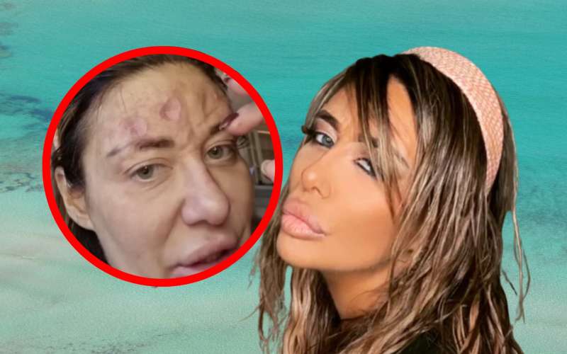 Ana je zaradi različnih kožnih težav obiskovala bolnišnico, vendar ni nadaljevala s predpisanimi ter