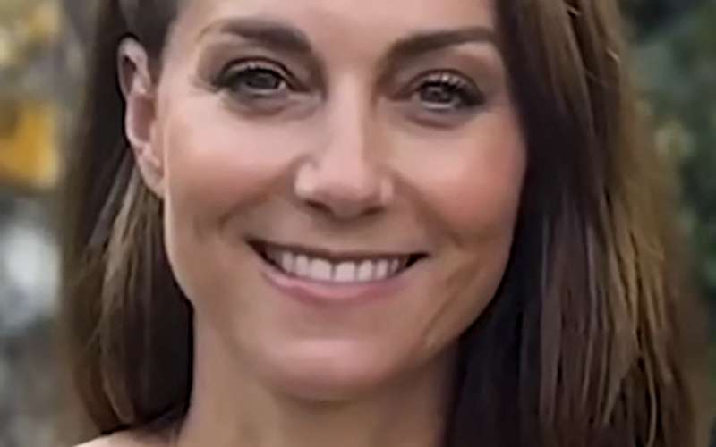 Kate je trpela veliko pred operacijo.