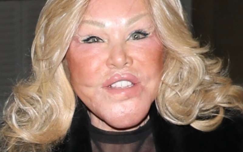 Jocelyn Wildenstein