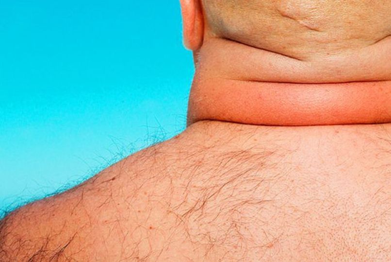 neck