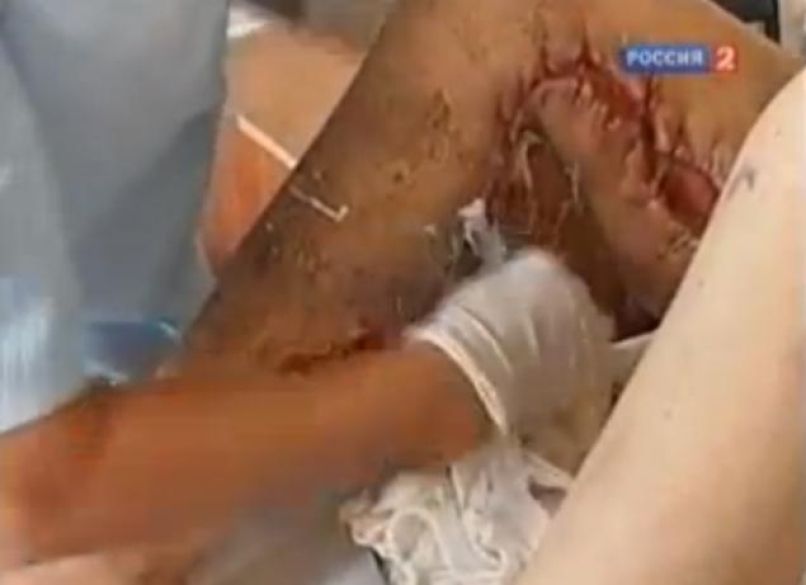 Krokodil