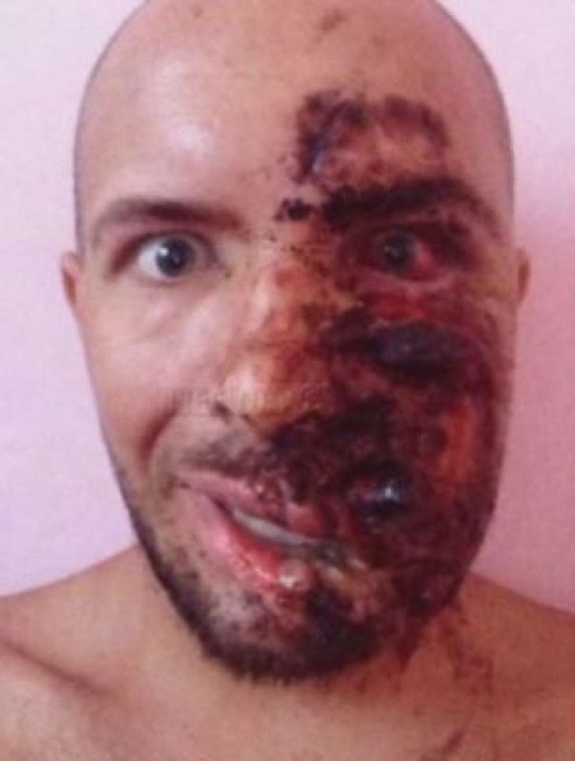 Sergej bogdanov, pretepen, iznakažen obraz1