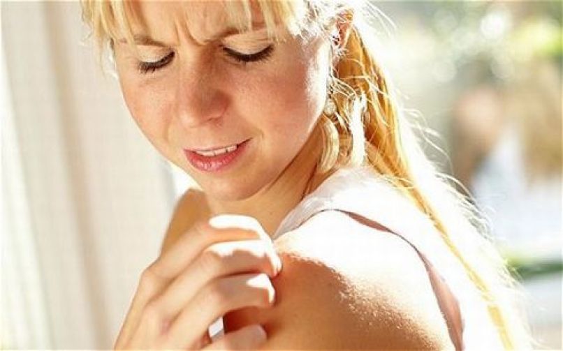 skin_irritation_home_remedies