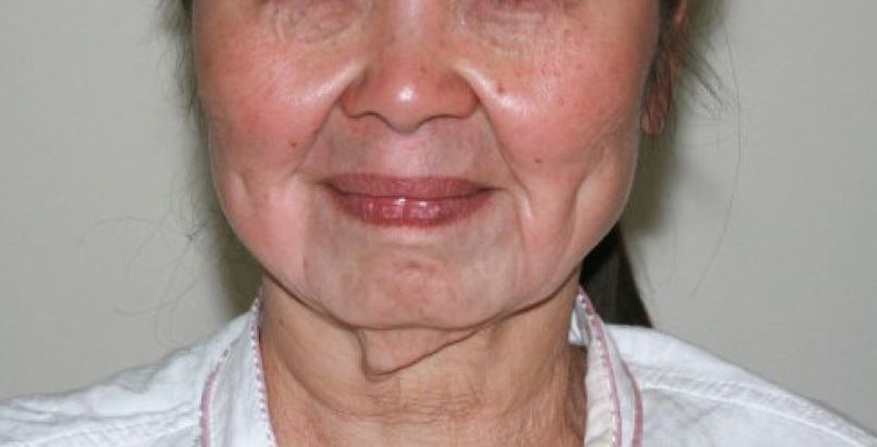 Hu Juan