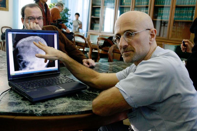 Sergio Canavero