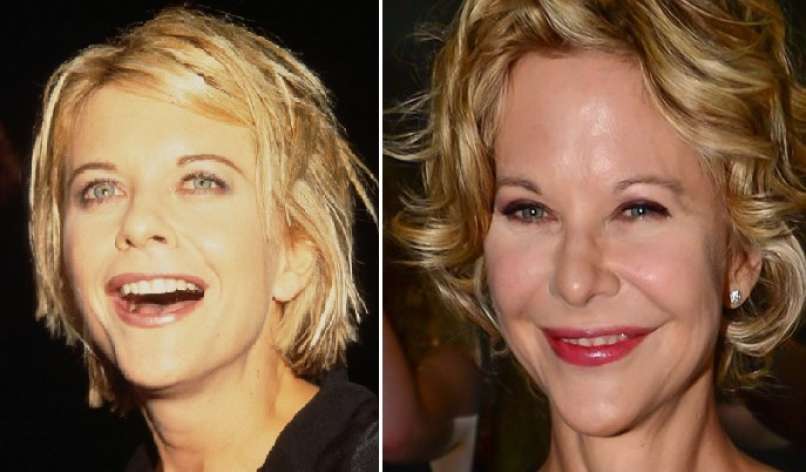 Meg Ryan