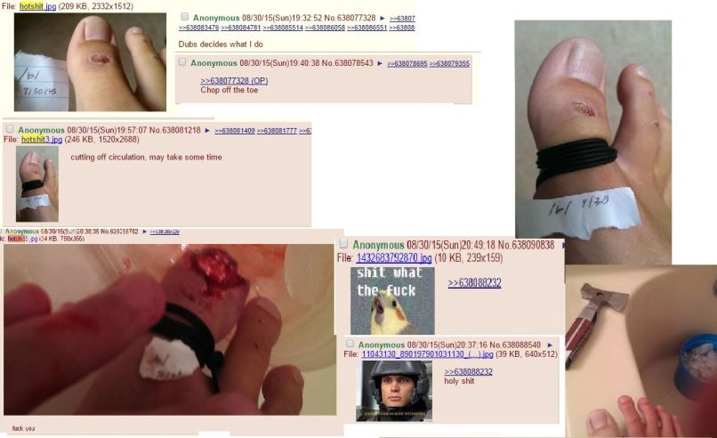 prst odsekan 4chan