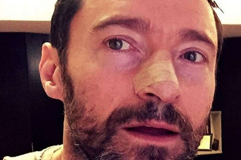 Hugh-Jackman