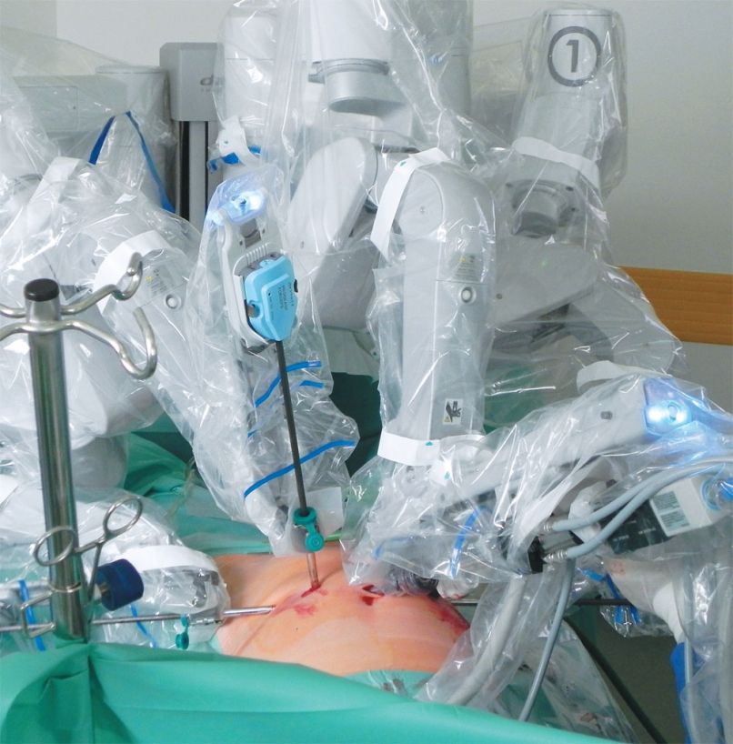 robot medicina