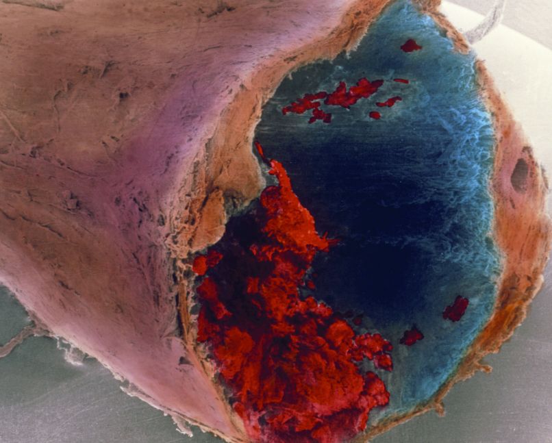arterija
