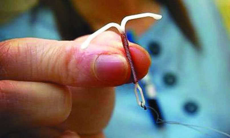 kontracepcija iud bakren