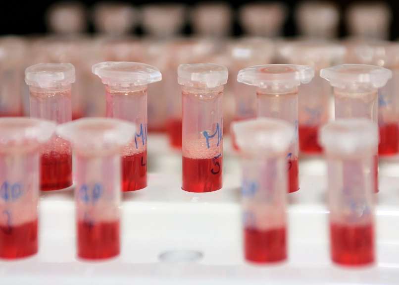 doping test