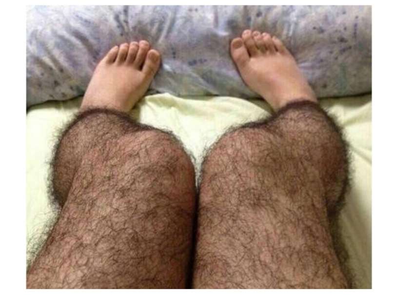 Hairy_legs