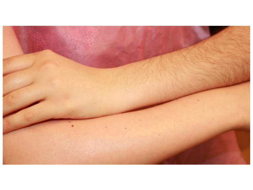 Arms