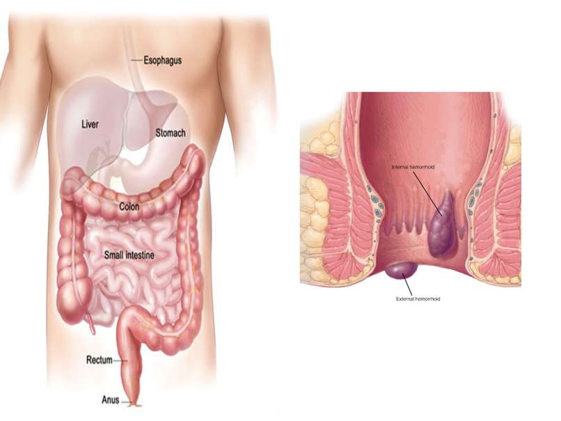 Body_scheme