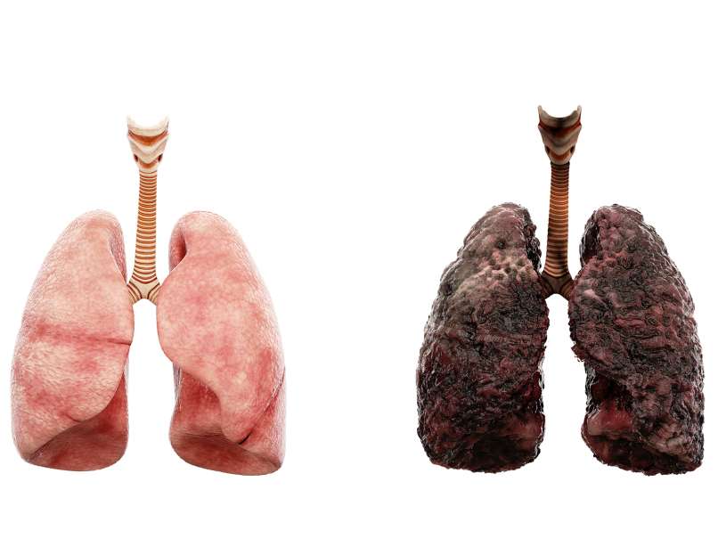 Lungs