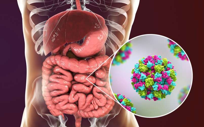 norovirus