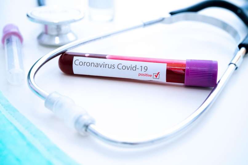 koronavirus covid-19