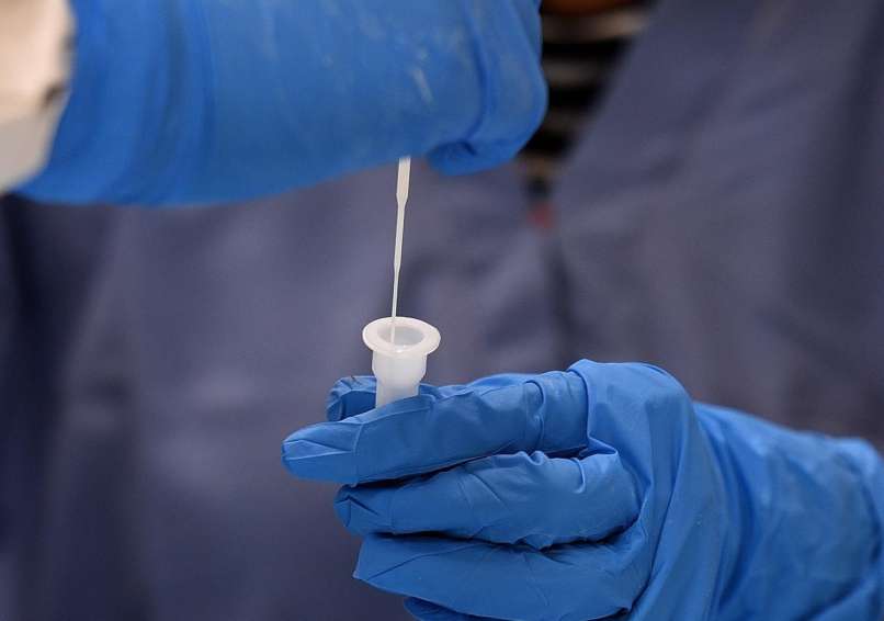 koronavirus, test
