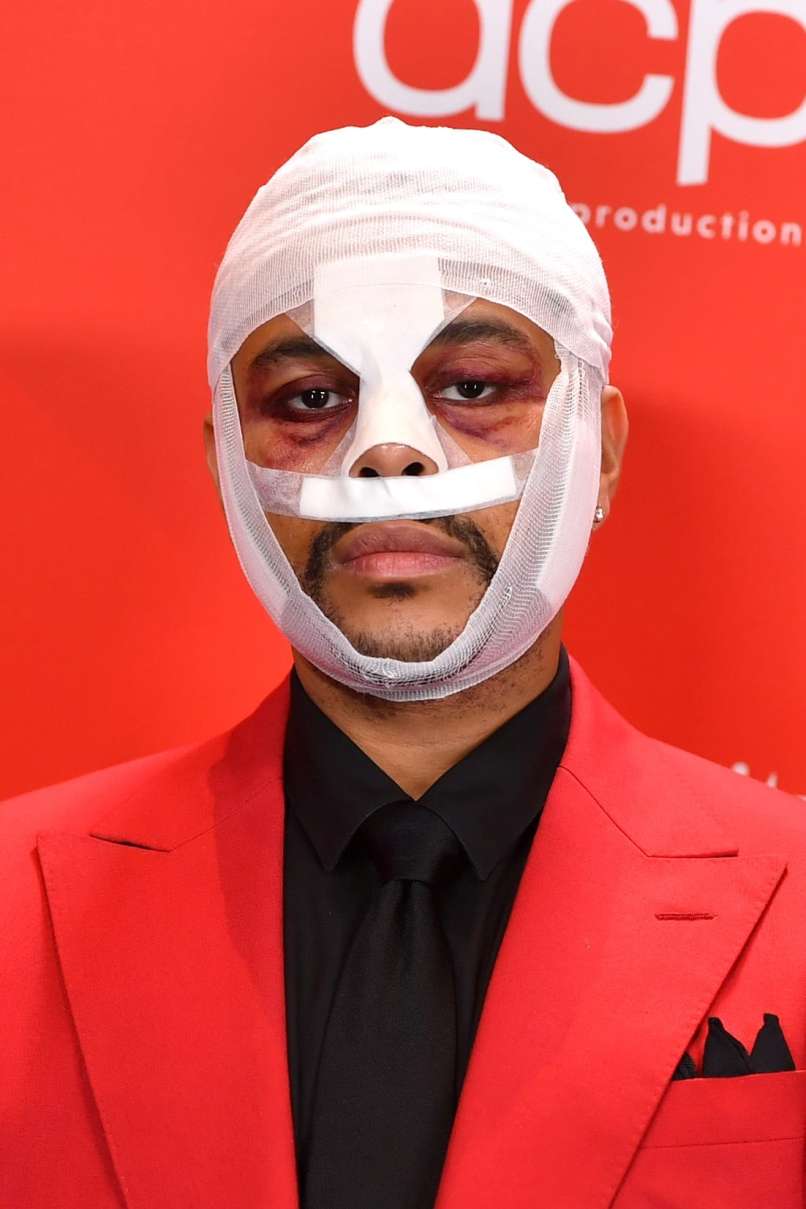 amas 2