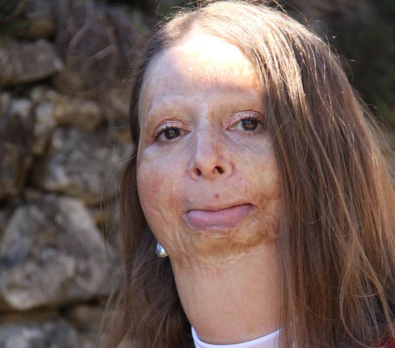 katja-škerlj