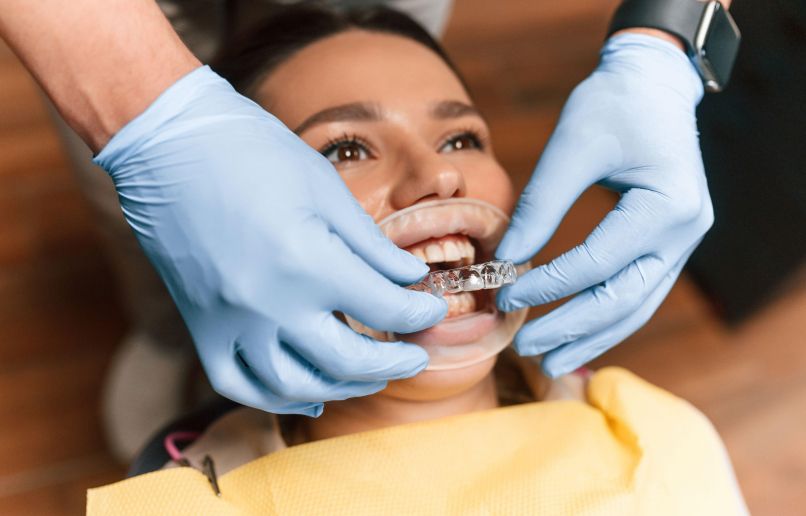 Invisalign, nevidni zobni aparat