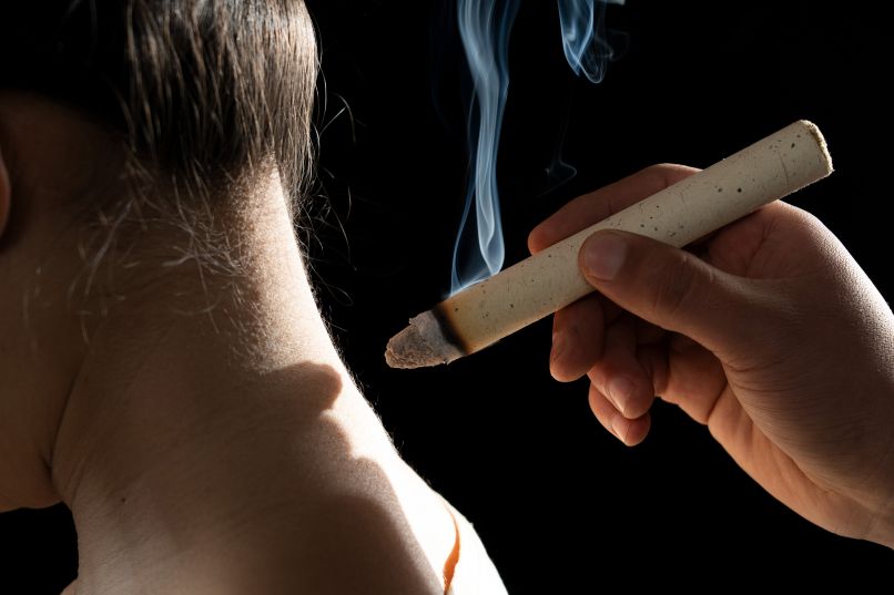 Moxibustion