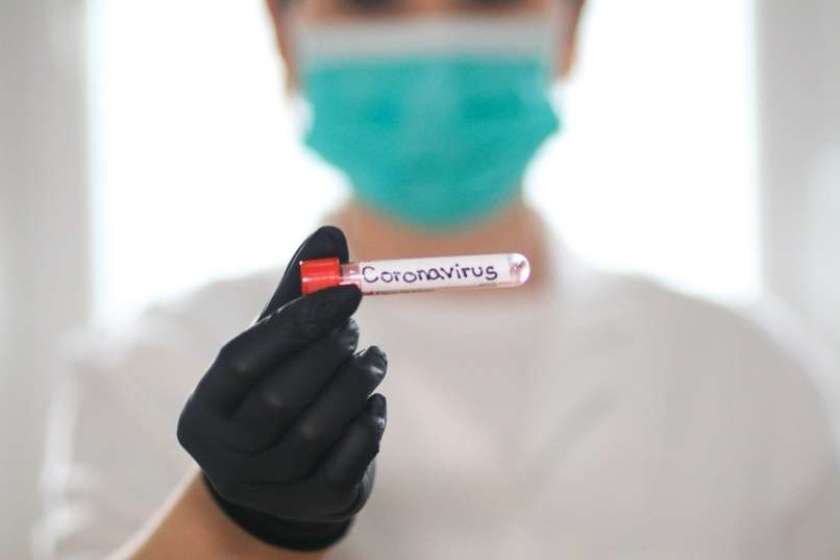 Vabila za sodelovanje v raziskavi o koronavirusu poslana 3000 prebivalcem