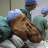 huang-tumor2.jpg