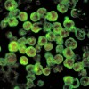 ameba Naegleria fowleri.jpg