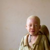 Albino 2.jpg