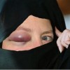 dubaj emirati islam žena pretep modrica tony