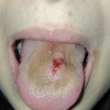 jezik strela piercing