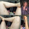 Beth Stelling, modrice