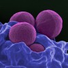 MRSA bakterija