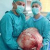 kirurgi odstranili tumor 31 kilogramov Banka Luka.jpg