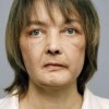 Isabelle Dinoire.jpg