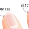 nohti.jpg