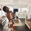 Winnie Harlow.png